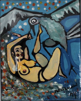 Woman in Bird Attack